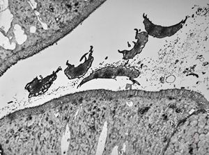 Giardia (Lamblia) intestinalis Giardia (Lamblia) intestinalis